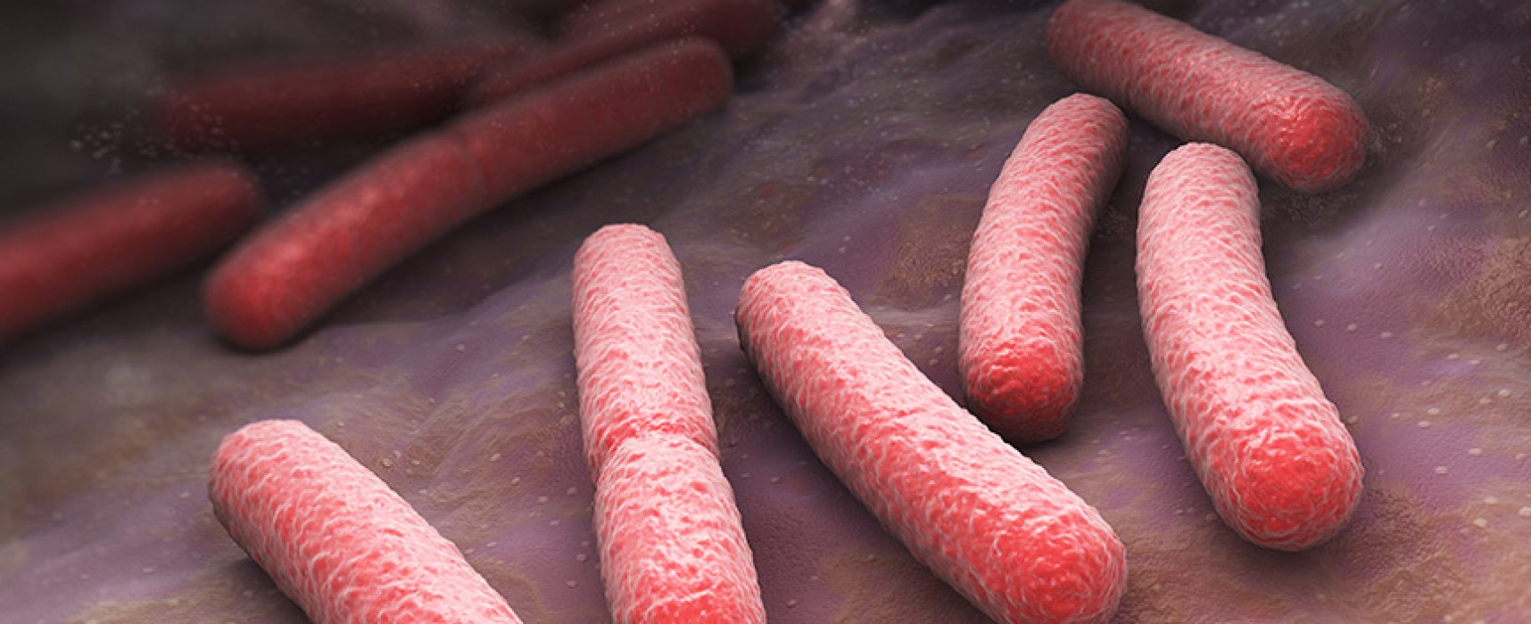 Cómo evitar la bacteria E.Coli