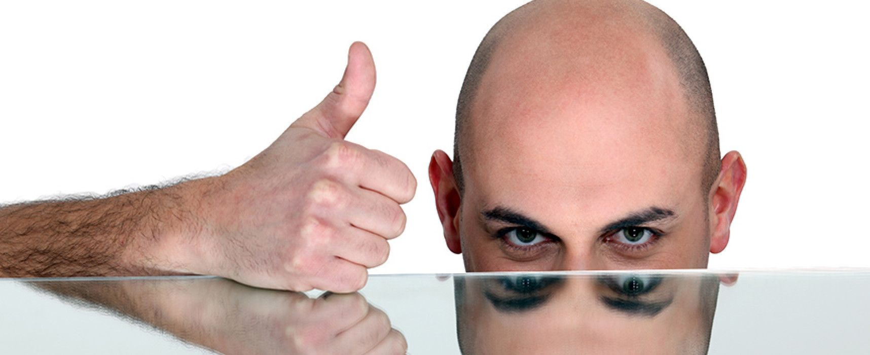 Tipos de alopecia o calvicie