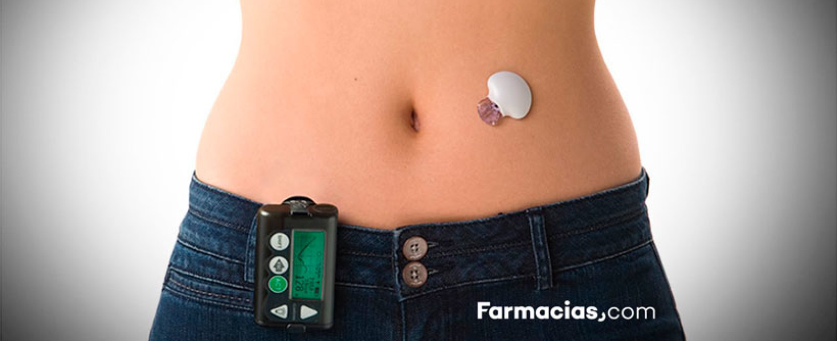 Un páncreas artificial para la diabetes de tipo 1