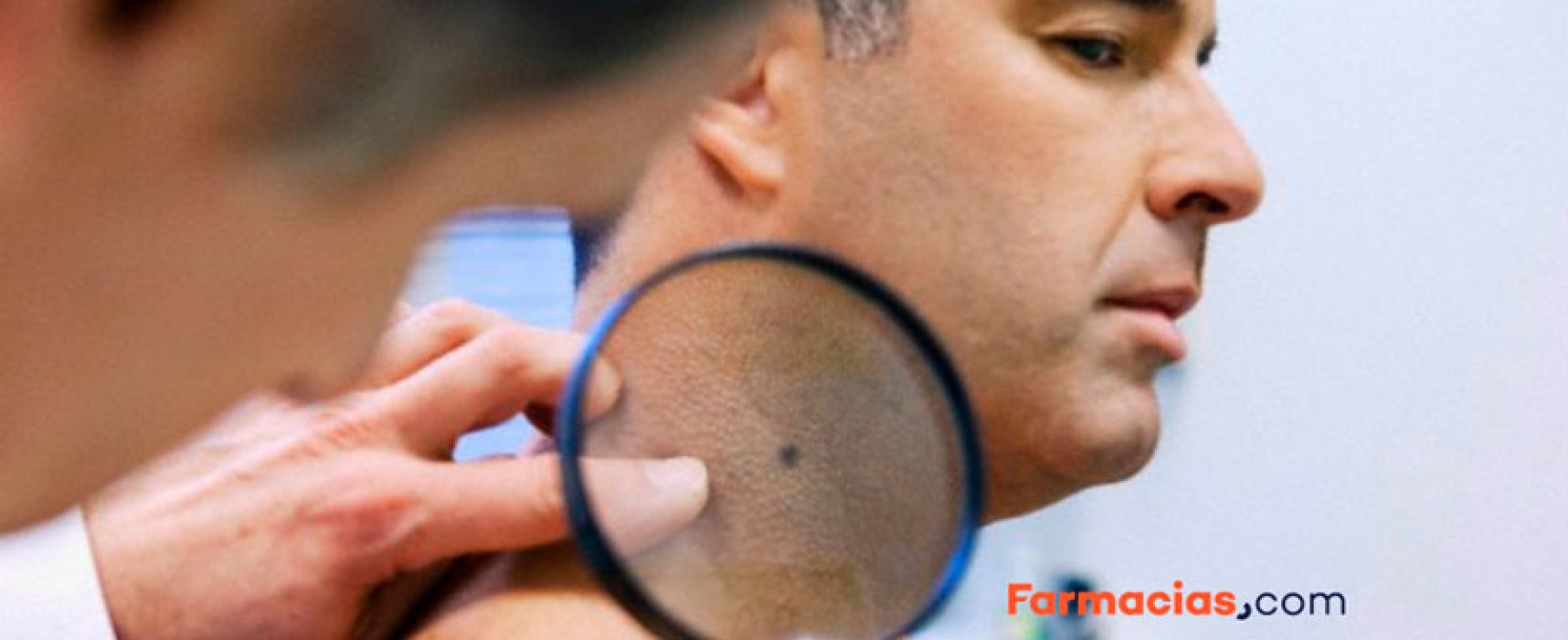 Oscurecimiento de la piel del cuello: ¿Qué hacer?